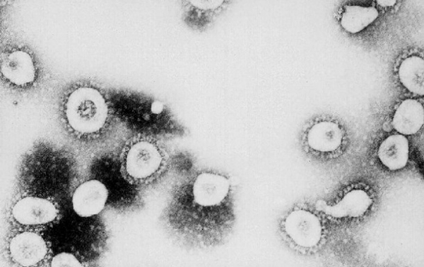 Вакцина от COVID-19: заразиться согласились 20 тысяч волонтеров
