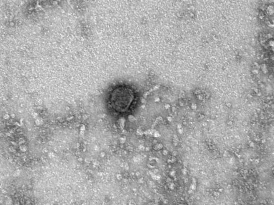 Российские ученые опубликовали первые снимки коронавируса под микроскопом