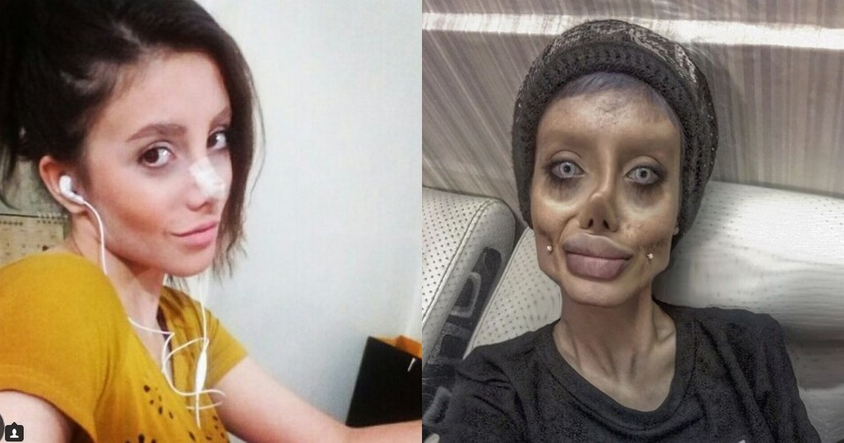 Женщина умерла после пластической операции. Сахар табар и Анджелина Джоли. Иранская табар Анджелина Джоли. 50 Операций похожа на Анджелину Джоли.